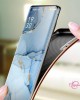 Xperia pro i 携帯電話ケース ソニーの新しい電気メッキ本革落下防止カバー Xperia pro i 携帯電話ケース ソニーの新しい電気メッキ本革落下防止カバー